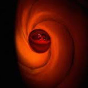 Meet your Posher, Mikiosenpai